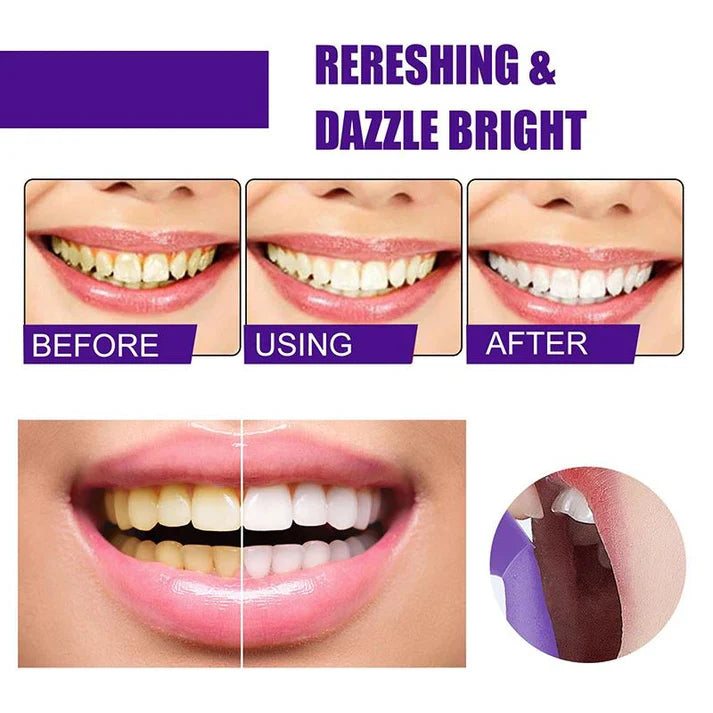 WHITESMILE ™ Dentifrice violet Ultra Blanchissant.